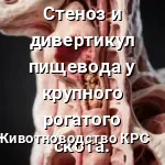 Сужение (стеноз) и расширение (дивертикул, эктазия) пищевода