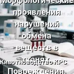 нарушения обмена веществ
